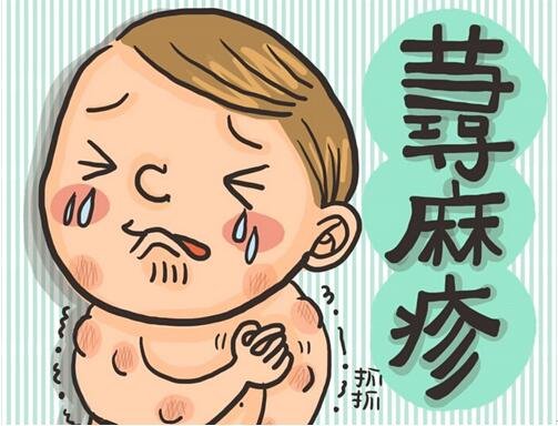 海口治疗荨麻疹的医院